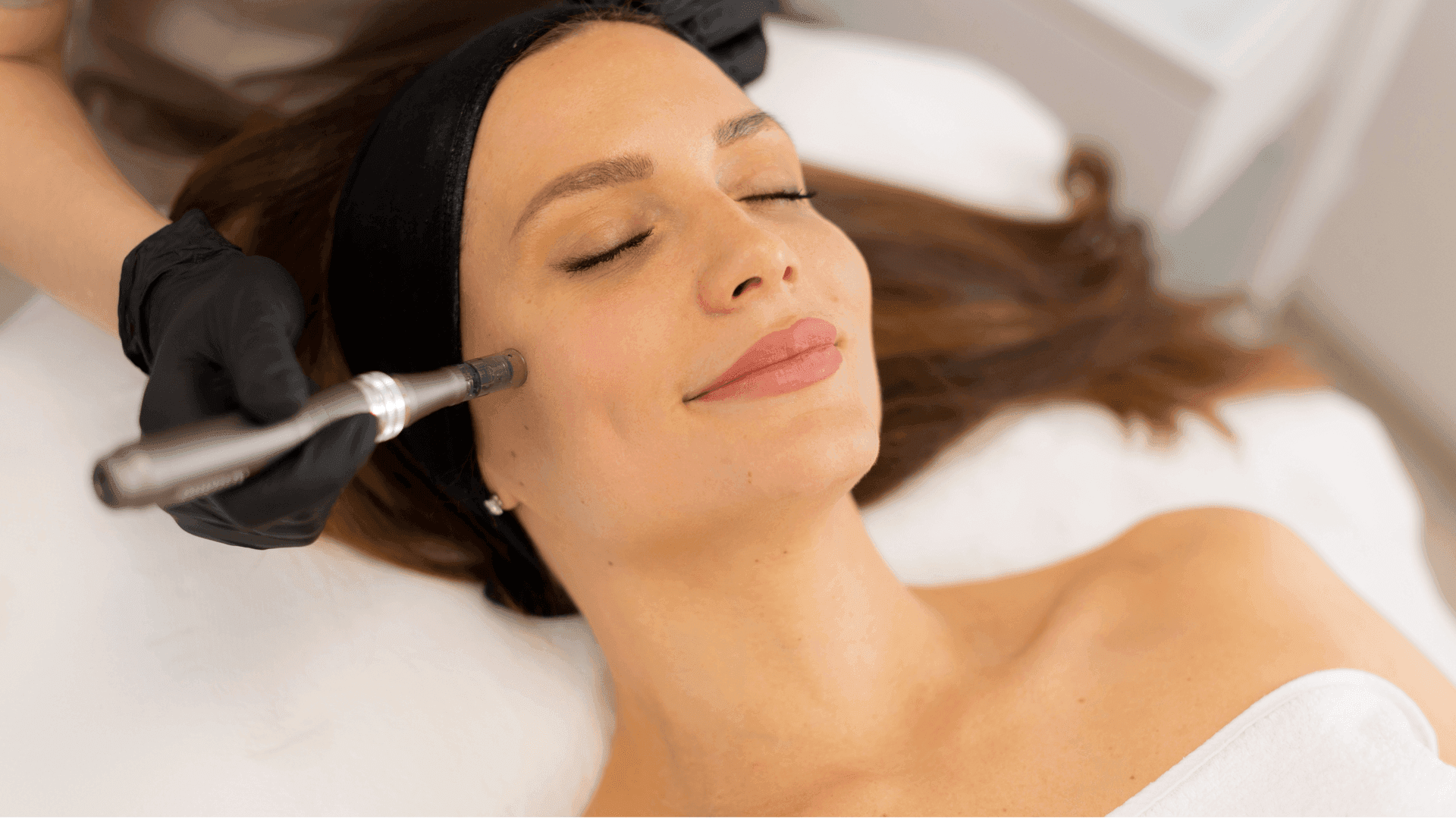 Microneedling